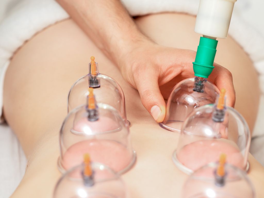 Cupping Recovery & Massage