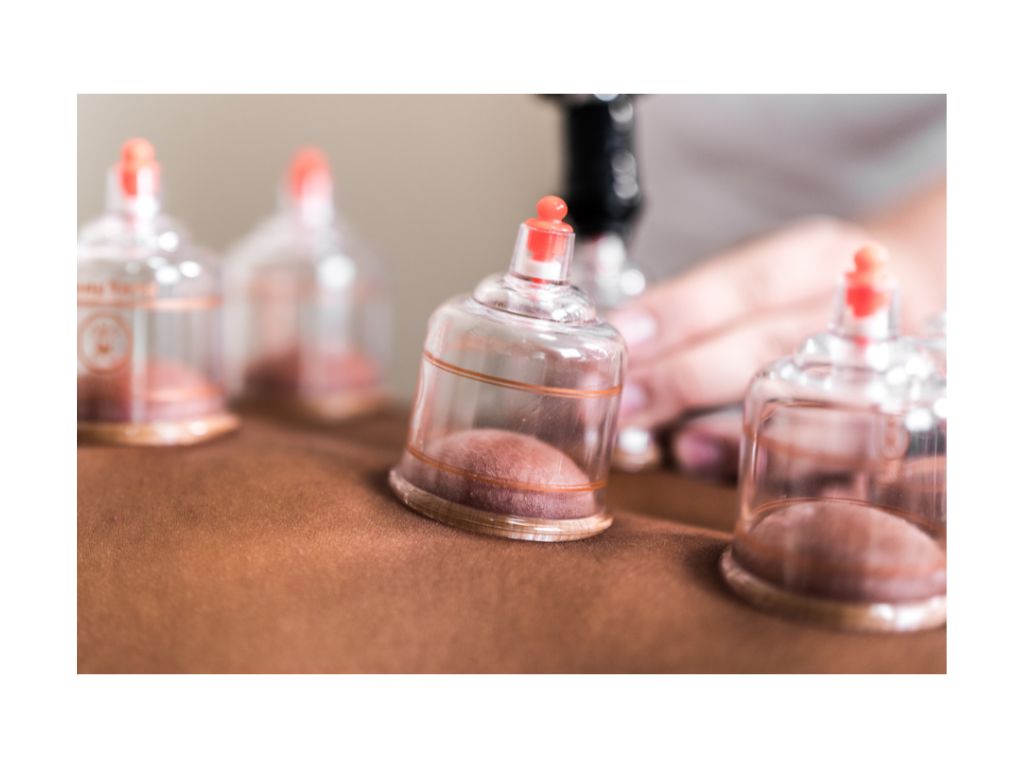 Hijama (Wet Cupping)