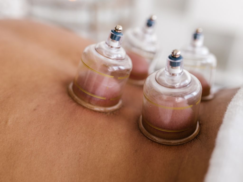 Dry Cupping and Massage Course